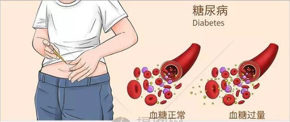 降低血糖有什么好方法吗,上门取货_123随叫随到