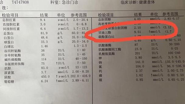 降甘油三酯的技巧,快递单号查询_123随叫随到