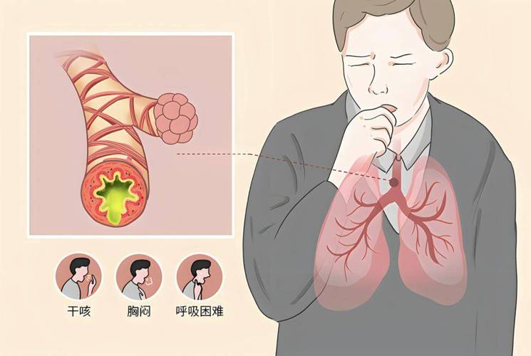 男子咳嗽咳断了肋骨,专业的一站式物流信息网_123随叫随到